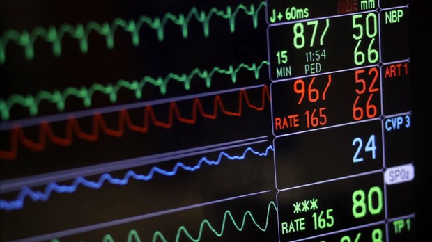 Le taux de mortalité des maladies du cœur et AVC a reculé au Canada