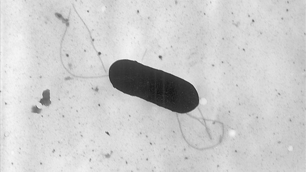 Lait végétal: de nouvelles infections par la bactérie Listeria signalées au Canada