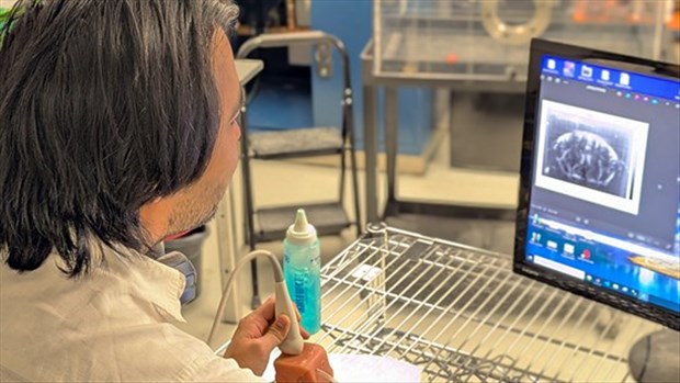 La circulation sanguine du cerveau est cartographiée de manière sans précédent